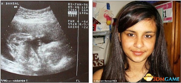 此一时彼一时：可追溯到1996年1月3日的苏曼·班赛尔的B超照，和17岁少女的照片