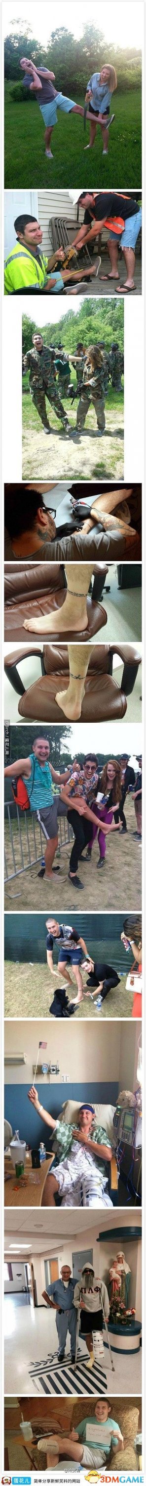 一个患了
严重腿疾的小伙需要截肢,临手术前他拍了些照片为他即将失去的左脚留念。在别人眼里这
可是伤痛欲绝的