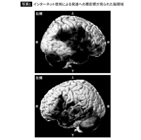 日本专家三年研究：中学生入学得到手机脑力直接停滞在小学
