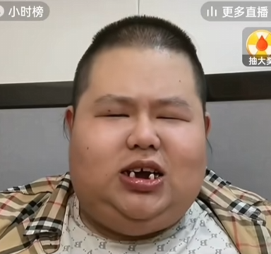380斤的良子大胃袋，笑着走向他的“死亡结局”