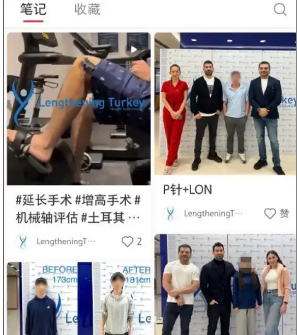 “断骨增高术”国内死灰复燃 专家警告风险依然巨大