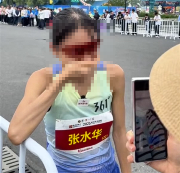 “最快女护士”张水华宣布辞职:50天内赢20万元奖金