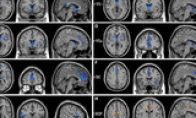 The latest research of the Chinese Academy of Science