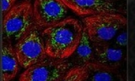 "Overwhere in Star Wars" upgrade and add protein mini -game to benefit human medicine