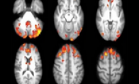Foreign studies say that playing computer video games may treat central nervous disease
