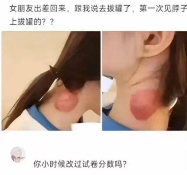 3DM輕松一刻第1481期 網(wǎng)紅教你一步到位進(jìn)醫(yī)院！