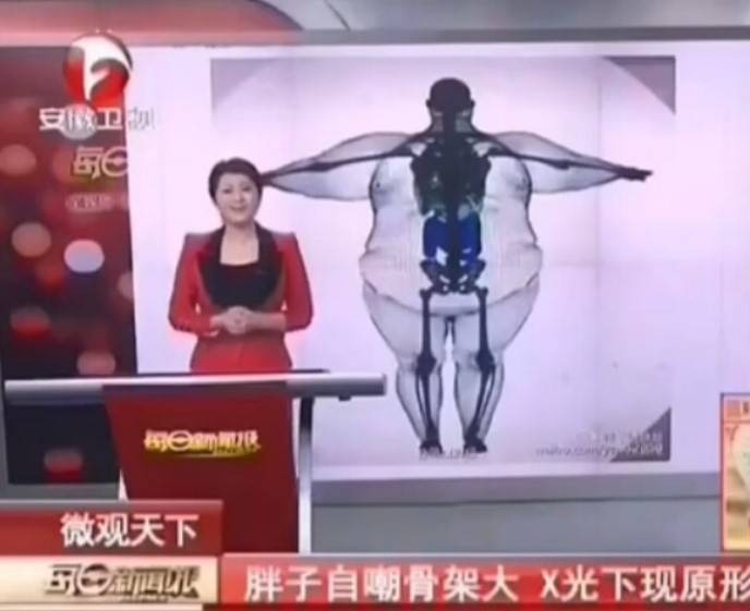 轻松一刻第1518期 只要舞跳的好哪里都是舞台