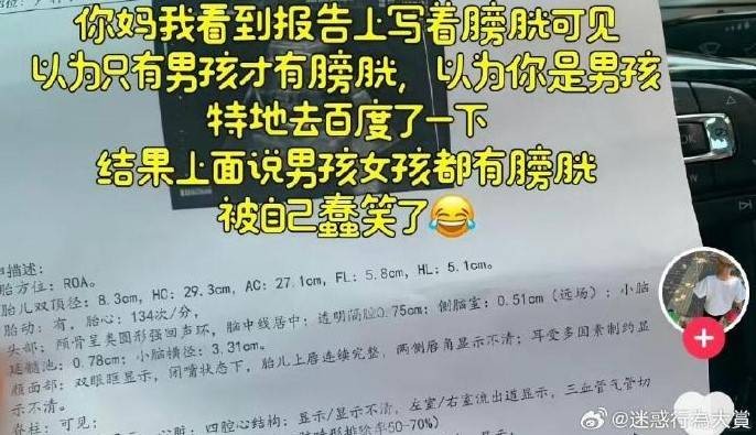 3DM轻松一刻第1579期 妹子解锁了一字马新用法！